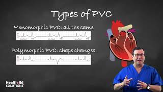 One Quick Question What are PVCs Premature Ventricular Contractions [upl. by Selassie440]