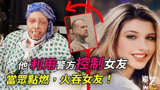 男友點火後安靜觀賞她被燒过程，他曾報警30多次求保愛情；女人奇蹟存活，她留下了遺言，卻也是被判了“終身監禁” ——Judy Malinowski案詳細始末 [upl. by Acinorav]