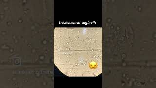 Trichomonas 🧫 Parasitologia [upl. by Ellirpa]