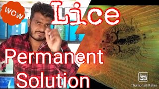 Aquarium lice Argulus complete guide  Solution [upl. by Esinehs]