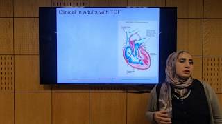 Fallot Tetralogy Part 1  Soha Romeih [upl. by Derwon72]