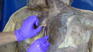 From Grant’s Dissection Video Collection Superficial Muscles of the Back [upl. by Eppes]