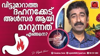 വിട്ടുമാറാത്ത ദഹനക്കേട് അൾസർ ആയി മാറുന്നത് എങ്ങനെ [upl. by Burger]