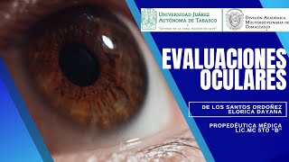 Evaluaciones oculares [upl. by Dominy]