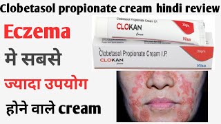 Clobetasol propionate cream ip  Clobetasol propionate cream ip uses in hindi  clokan cream hindi [upl. by Ydnirb]