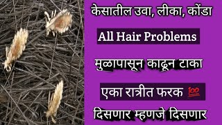 उवा लीका खात्रीशीर घालविण्याचा उपाय Licel Lice Killer For all Hair problems Licel In Marathi [upl. by Glori628]