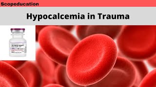 Hypocalcemia in Trauma [upl. by Ddej17]