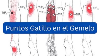 Puntos Gatillo en el Gemelo Cómo Identificarlos [upl. by Renrew]