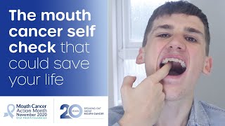 How to do a mouth cancer check at home [upl. by Yukio]