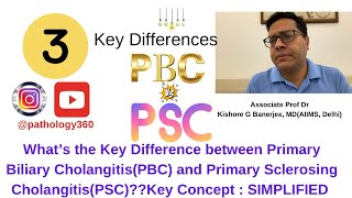 Primary Sclerosing Cholangitis PSC versus Primary Biliary Cholangitis PBC  medicine medicos [upl. by Trocki757]