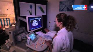 KWF Voorlichtingsvideo Echografie [upl. by Anitsirhc]