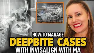 Invisalign with MA Deepbite Cases [upl. by Rodrich246]