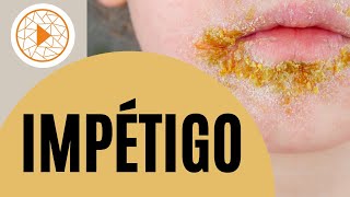 IMPETIGO  ¿Qué es Descubre los síntomas y su prevención [upl. by Harima]