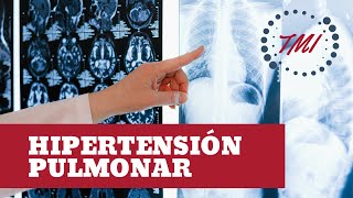 Hipertensión Pulmonar [upl. by Also]