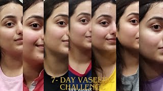 I applied Vaseline petroleum jelly on my face for 7 days  Results and benefits [upl. by Heiney301]