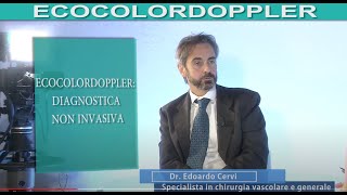 ECOCOLORDOPPLER lesame che scova linsufficienza venosa di arterie vene e capillari [upl. by Amarette]