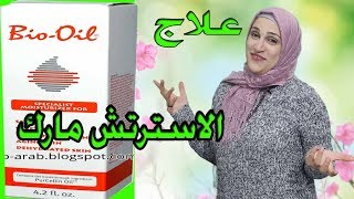 كيف أتخلص من الخطوط البيضا والحمراء وتشققات الحمل  الاسترتش مارك [upl. by Vandyke310]