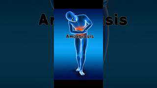 Amoebiasis Symptoms and Diagnosis Explained  MRCP UK MRCP Ireland NEET PGquot ocean of medicine [upl. by Lennie]