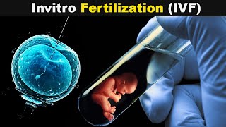 How Test Tube Babies Are produced  Invitro Fertilization UrduHindi [upl. by Jonell900]