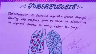 health talk on tuberculosis  flash card on TB nursingstudies6110 [upl. by Illona]