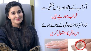 Best Solution for dry skin of hand and feet by Dr Shaista Lodhi  Ladies Talk [upl. by Berglund]