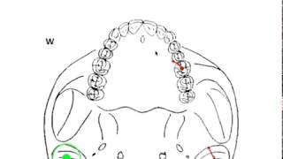 DYNAMIC OCCLUSION  Working vs Nonworking Movement amp Occlusal Grid [upl. by Malvina]