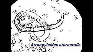 Strongyloides stercoralis [upl. by Godrich]