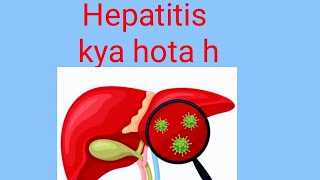 hepatitis bhepatitis chepatitishepatitis aviral hepatitishepatitis b treatment [upl. by Gilba]