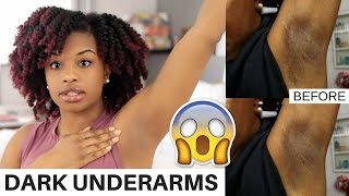 How To Lighten Dark Underarms Naturally and Fast  BEFORE AND AFTER RESULTS  journeytowaistlength [upl. by Nezam]