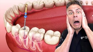 Dentist Reveals What REALLY Happens In A Root Canal [upl. by Stormie]