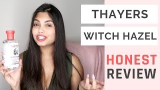 Thayers Witch Hazel Review Is it Worth the Hype  Social Nupur [upl. by Landau]