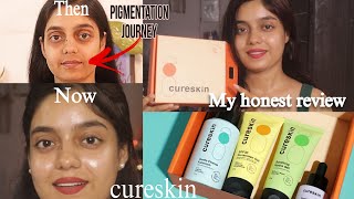 Skin journey with Cureskin  Honest review Pigmentation and Open Pores real or fake [upl. by Erdei]