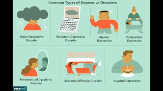 Trattamenti per la depressione maggiore [upl. by Aitercul]