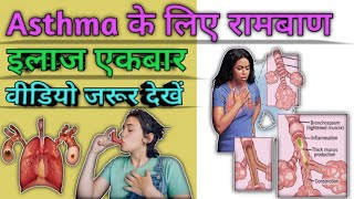 Asthma  What is Asthma  Treatment of asthma [upl. by Anilok]