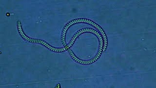 The Biggest Bacterium Ive Ever Seen Possibly a Spirochaete sp [upl. by Olegna121]