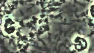 Spirochetes under phase contrast microscope [upl. by Arremat]