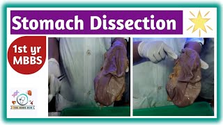 Stomach Dissection  Anatomy of Stomach  Dissection viva voce mbbs doctor stomach anatomy [upl. by Oiramal]