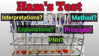 Hams Test for PNHPNH diseaseHams test HematologySTAR LABORATORY [upl. by Ephram]