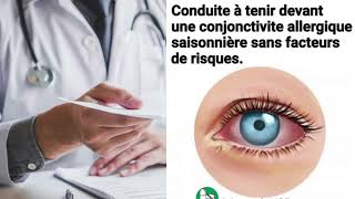 Conjonctivite Allergique Saisonnière  Conduite à Tenir et Traitements [upl. by Emelun61]