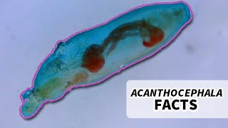 Acanthocephala Facts the Thorny Headed Worm  Animal Fact Files [upl. by Ahsatak]