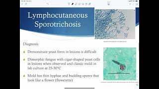 Subcutaneous mycosis [upl. by Oppen]