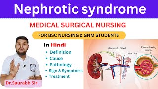 Nephrotic syndrome  medical surgical nursing  For Bsc Nursing and GNM and medical students [upl. by Merralee]