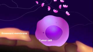 Introduction to Cancer Biology Part 3 Tissue Invasion and Metastasis [upl. by Airak]