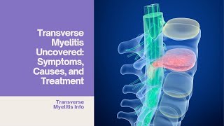 Transverse Myelitis Uncovered Symptoms Causes Diagnosis and Treatment [upl. by Doy]