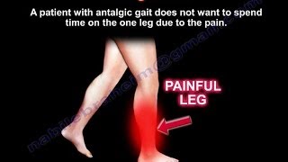 Antalgic Gait  Everything You Need To Know  Dr Nabil Ebraheim [upl. by Yolane]