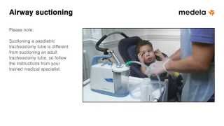 Tracheostomy Suctioning  Airway Suctioning [upl. by Atem]