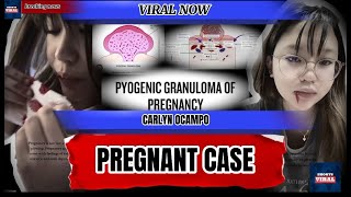 Carlyn ocampo pregnant case [upl. by Laehplar]