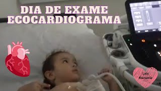 ECOCARDIOGRAMA  EXAME DE ROTINA [upl. by Audrey]