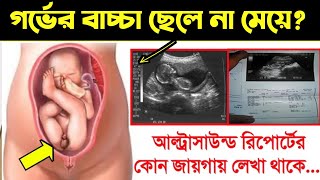 আল্ট্রাসাউন্ড রিপোর্ট দেখে কিভাবে বুঝবেন গর্ভের বাচ্চা ছেলে না মেয়ে  আল্ট্রাসনোগ্রাফি রিপোর্ট [upl. by Novyart]