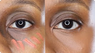 FULLY COVER DARK CIRCLES using Orange color corrector [upl. by Eirolam]